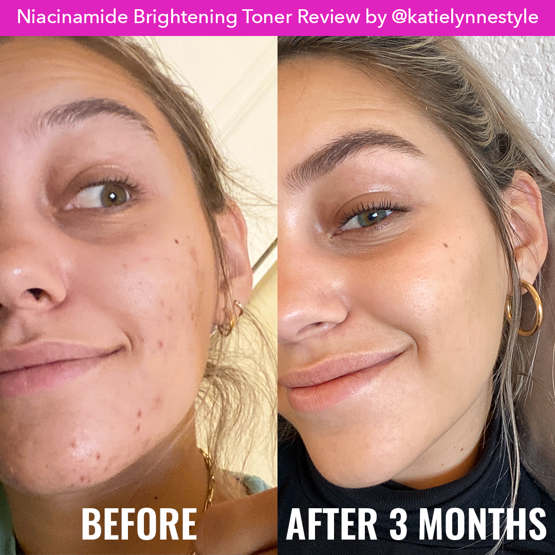 Niacinamide Brightening Toner Z6