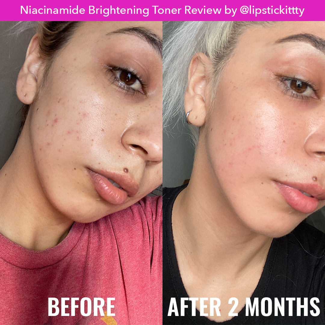 Niacinamide Brightening Toner Z6