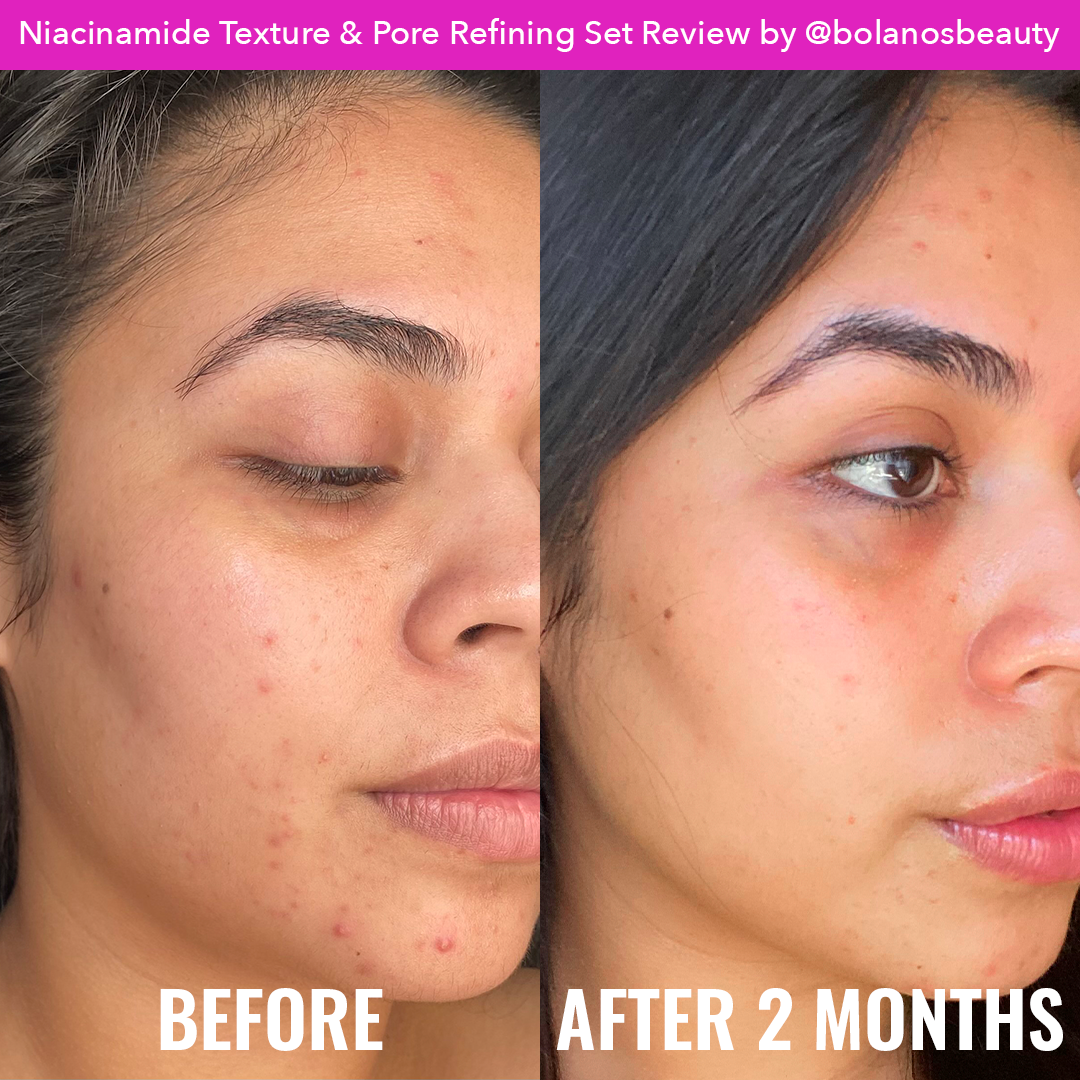 Niacinamide Texture & Pore Refining Set P8